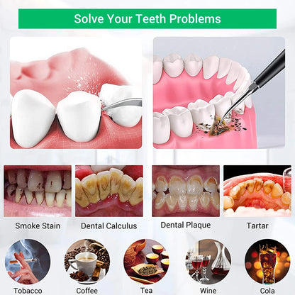 Dental Scaler Ultrasonic Tooth Cleaner Stone Removal Electric Sonic Plaque Remover for Teeth Stain Tartar Calculus Whitening